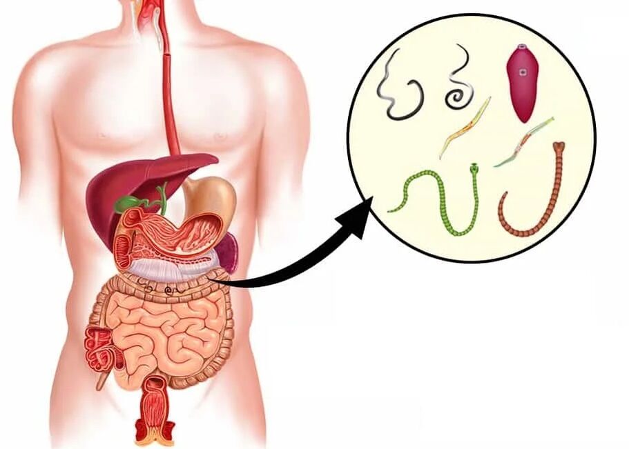 Vermixin axuda coa maioría dos tipos de helmintos