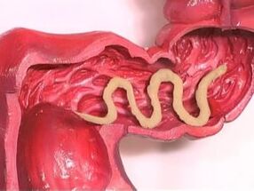 Localización no corpo humano